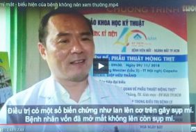 CO GIẬT MÍ MẮT