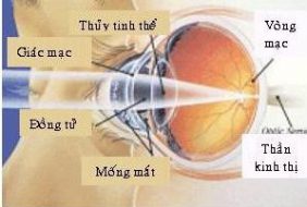 PHẪU THUẬT PHACO TRONG ĐIỀU TRỊ BỆNH ĐỤC THỦY TINH THỂ