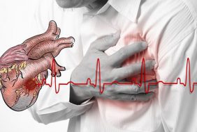 CƠN ĐAU THẮT NGỰC ỔN ĐỊNH