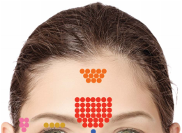 TIÊM FILLER VÀ BIẾN CHỨNG.