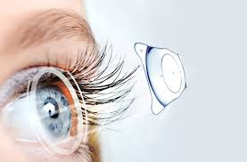 KHÔNG MỔ ĐƯỢC LASER, CÓ HOÀN TOÀN VÔ VỌNG KHÔNG?