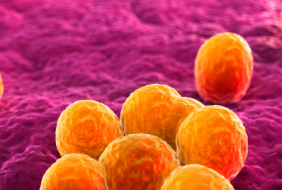 Nhiễm tụ cầu vàng kháng methicillin (MRSA) là gì?