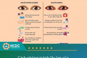 BỆNH ĐAU MẮT ĐỎ – NHỮNG ĐIỀU CẦN BIẾT