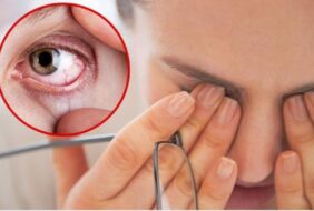Bảo vệ đôi mắt bạn trong những ngày thời tiết khô hạn